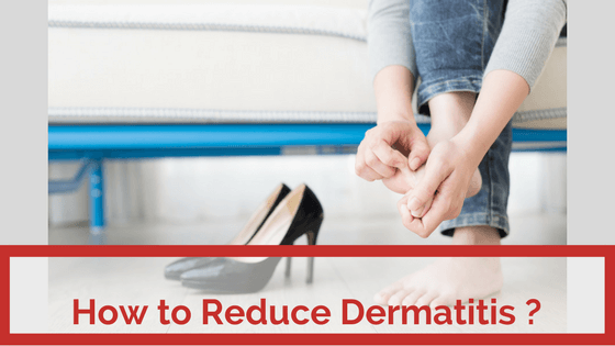 How to Treat Dermatitis