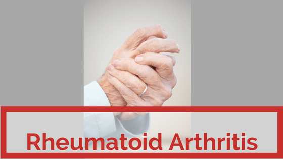 How to treat Rheumatoid arthritis